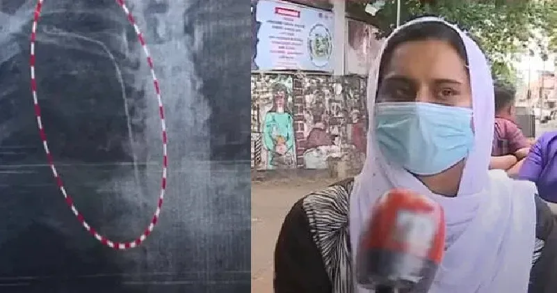 തിരുവനന്തപുരത്ത് ജനറല് ആശുപത്രിയില് ചികിത്സാ പിഴവ് : ശസ്ത്രക്രിയക്കിടെ വയര് ഉളളില് കുടുങ്ങി