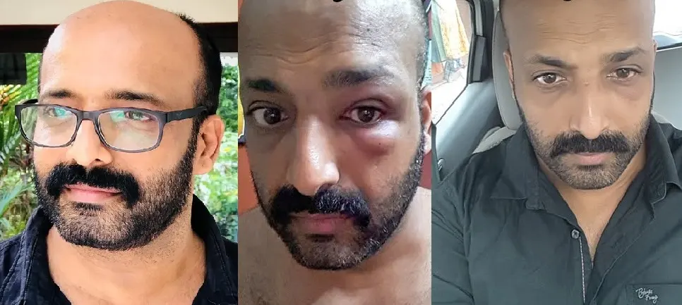 വൈറസ് ബാധയ്ക്ക് ബയോപ്സി ; ഓപ്പറേഷൻ ചെയ്ത് അവയവം നീക്കം ചെയ്യണമെന്ന് പറഞ്ഞത് പരിചയസമ്പന്നനായ ഡോക്ടർ ; എം ബി പദ്മകുമാർ