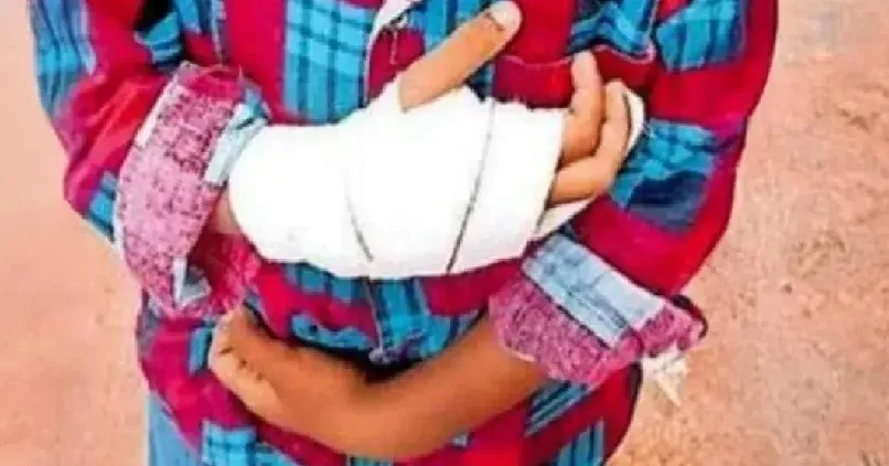 വേഗത്തിൽ എഴുത്താത്തിന് ഒന്നാം ക്ലാസുകാരിയ്ക്ക് മർദ്ദനം ; കൈവിരലിന് പരിക്ക്